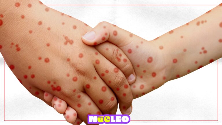 ¿Cómo funciona el esquema de vacunación contra el sarampión?